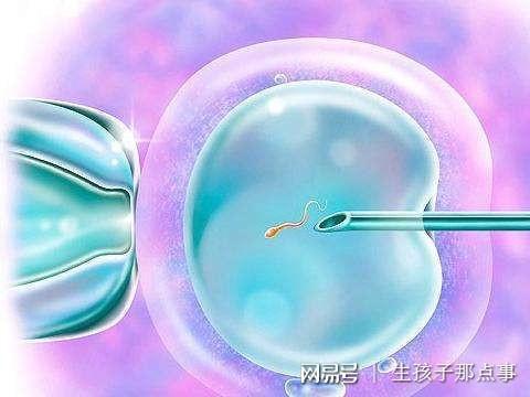 取卵