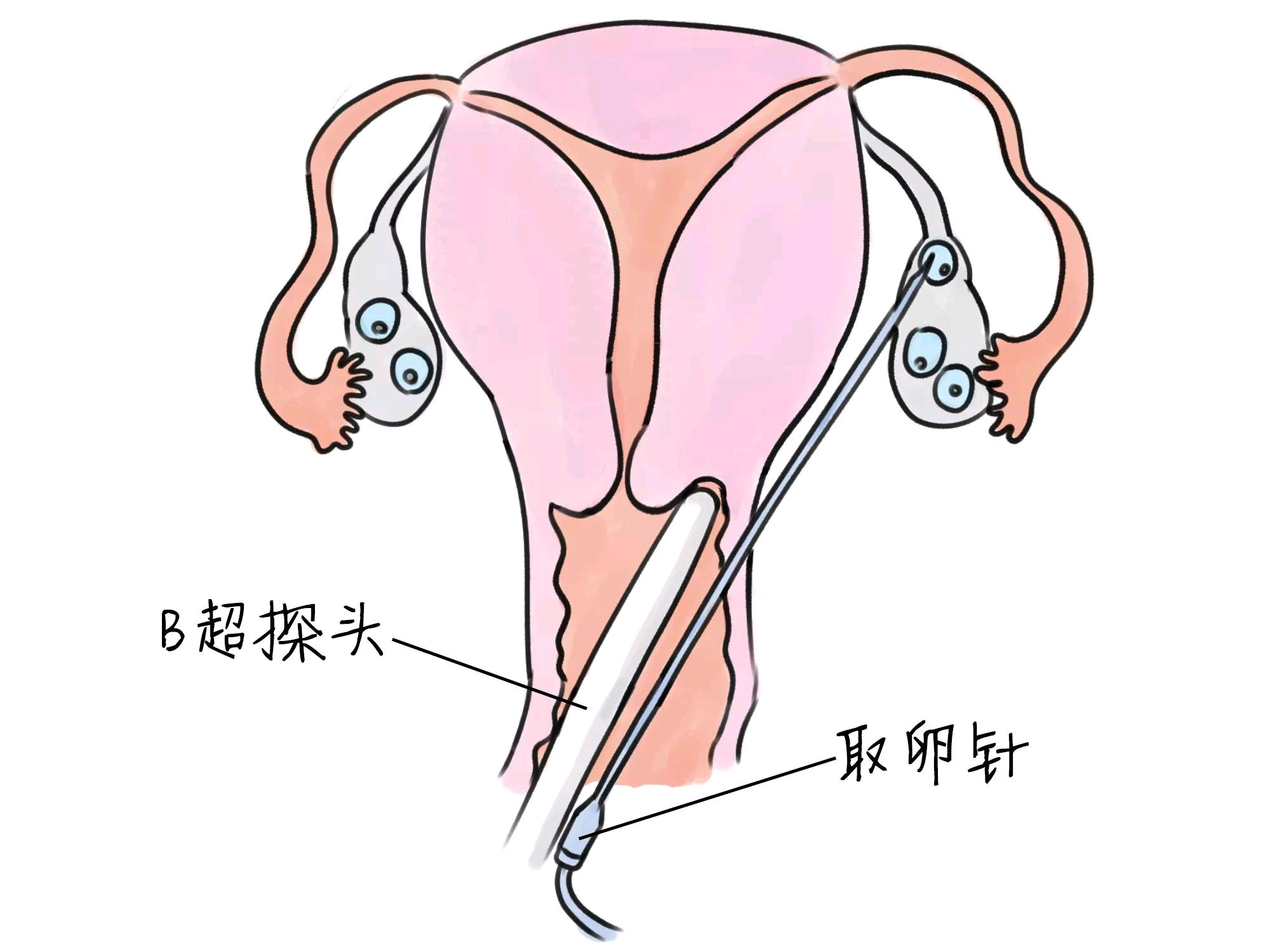 北京助孕中介