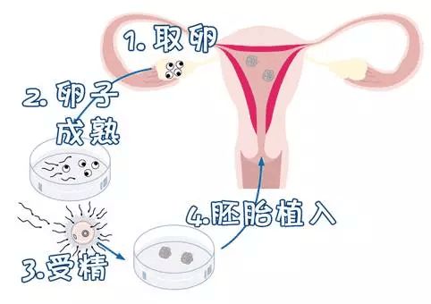 南宁试管婴儿医院