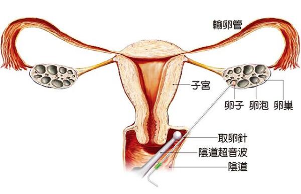 医疗费用