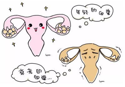卵巢性不孕