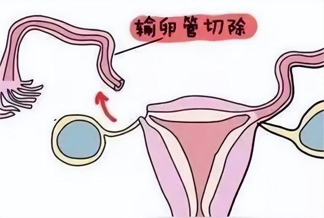 北京试管婴儿好
