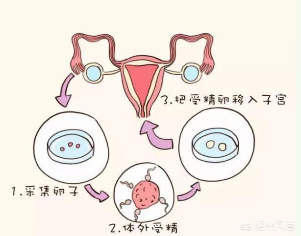 不孕不育